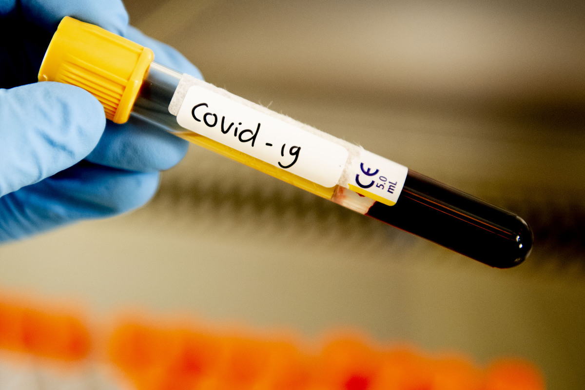 Сдайте анализ на COVID-19